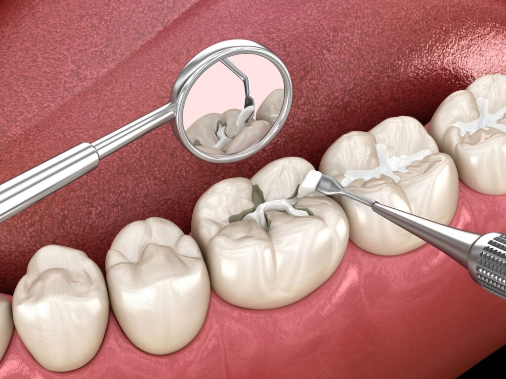 Soins conservateurs - La Passerelle 45